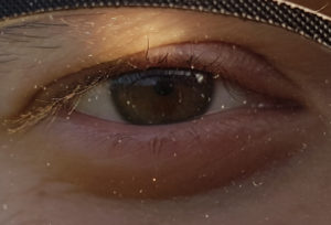 oog hebben